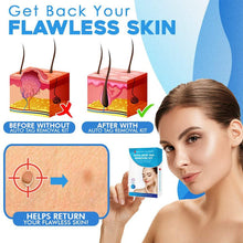 Load image into Gallery viewer, Skin Tag Removal Kit (2022)