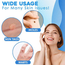 Load image into Gallery viewer, Skin Tag Removal Kit (2022)