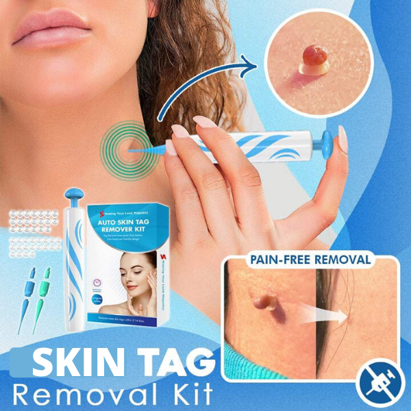 Skin Tag Removal Kit (2022) – LiveTheHome